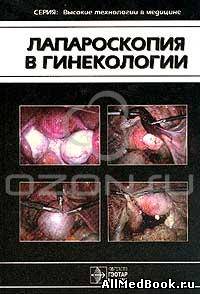 Лапароскопия в гинекологии